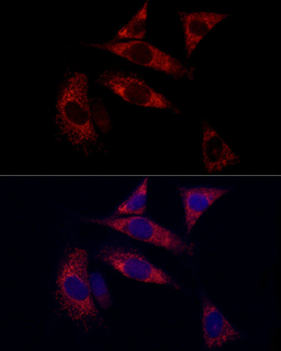 SURF4 Antibody in Immunocytochemistry (ICC/IF)