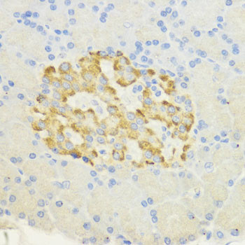 SURF4 Antibody in Immunohistochemistry (Paraffin) (IHC (P))