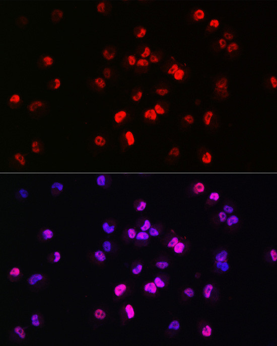 Brachyury Antibody in Immunocytochemistry (ICC/IF)