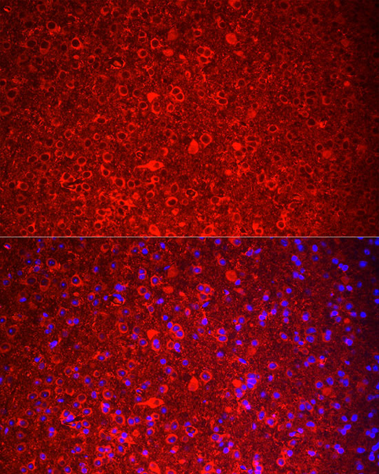 NKB Antibody in Immunocytochemistry (ICC/IF)