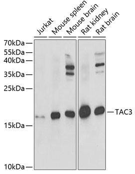 NKB Antibody in Western Blot (WB)