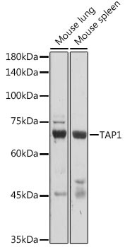 TAP1 Antibody in Western Blot (WB)