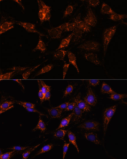 TBCC Antibody in Immunocytochemistry (ICC/IF)