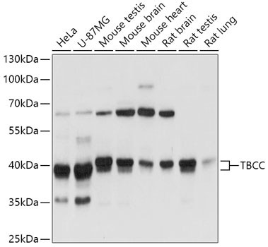 TBCC Antibody in Western Blot (WB)