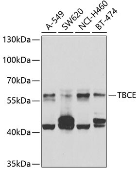 TBCE Antibody in Western Blot (WB)