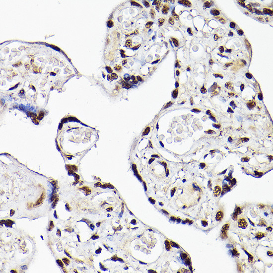 TBX20 Antibody in Immunohistochemistry (Paraffin) (IHC (P))