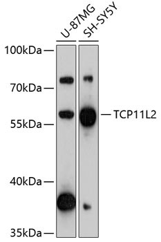 TCP11L2 Antibody in Western Blot (WB)