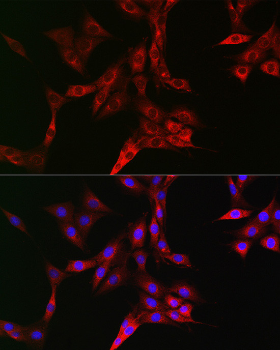 TFRC Antibody in Immunocytochemistry (ICC/IF)