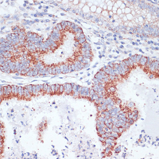 TFRC Antibody in Immunohistochemistry (Paraffin) (IHC (P))