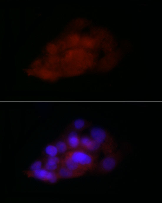 TIA-1 Antibody in Immunocytochemistry (ICC/IF)