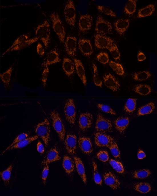 TOM20 Antibody in Immunocytochemistry (ICC/IF)