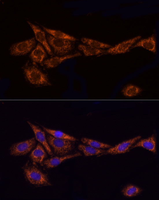 TOM20 Antibody in Immunocytochemistry (ICC/IF)