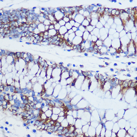 TOM20 Antibody in Immunohistochemistry (Paraffin) (IHC (P))