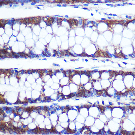 TOP1MT Antibody in Immunohistochemistry (Paraffin) (IHC (P))