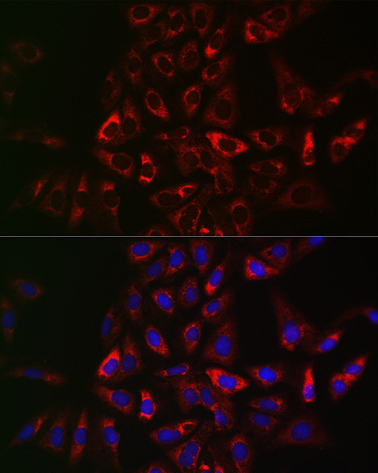 TRAF3IP2 Antibody in Immunocytochemistry (ICC/IF)