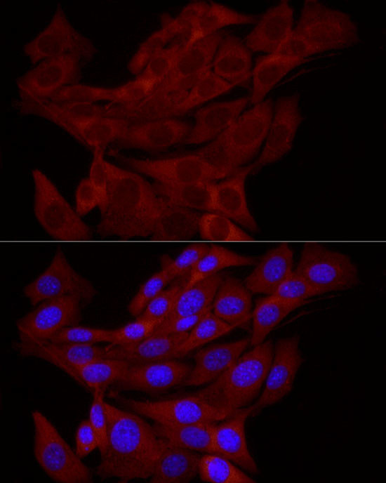 TRIM21 Antibody in Immunocytochemistry (ICC/IF)