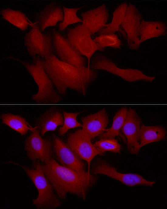 TRIM21 Antibody in Immunocytochemistry (ICC/IF)