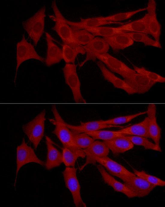 TRIM21 Antibody in Immunocytochemistry (ICC/IF)