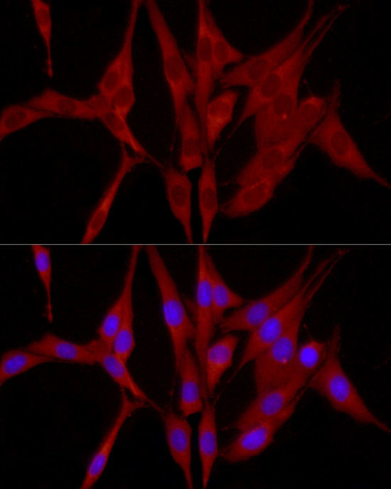 TRIM21 Antibody in Immunocytochemistry (ICC/IF)