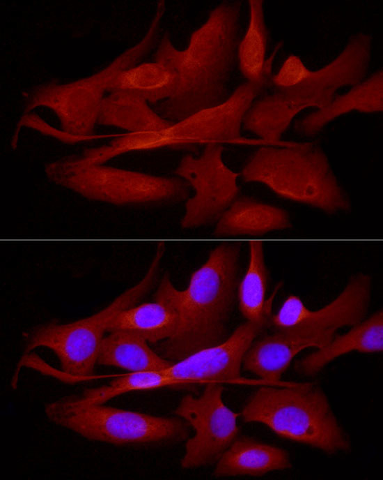 TRIM21 Antibody in Immunocytochemistry (ICC/IF)