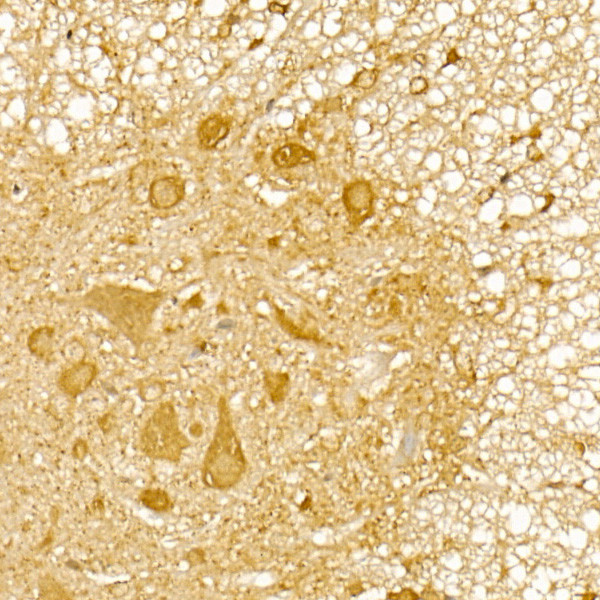 TRIM21 Antibody in Immunohistochemistry (Paraffin) (IHC (P))