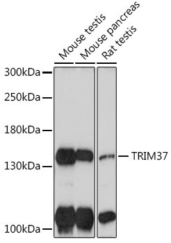 TRIM37 Antibody in Western Blot (WB)