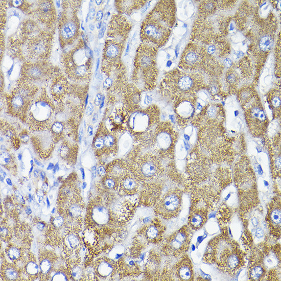 TST Antibody in Immunohistochemistry (Paraffin) (IHC (P))