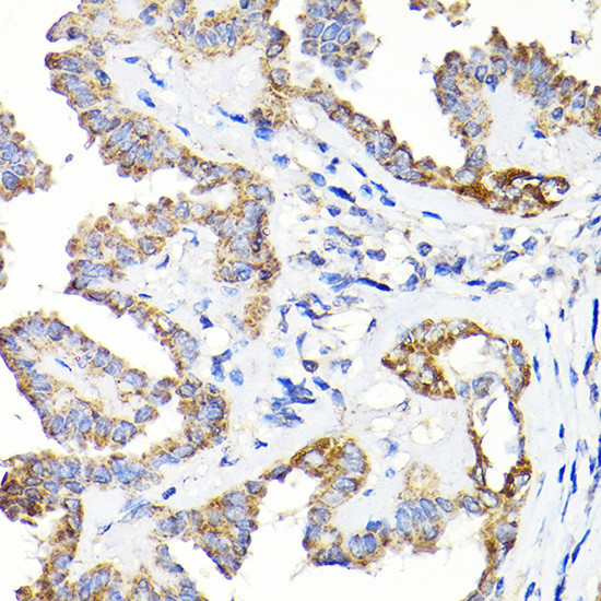 TST Antibody in Immunohistochemistry (Paraffin) (IHC (P))