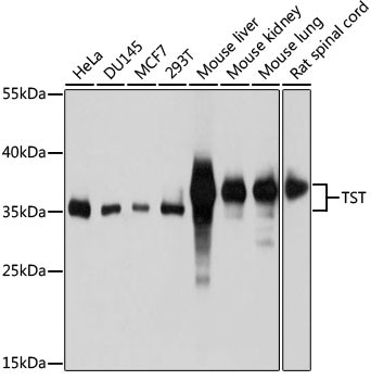 TST Antibody in Western Blot (WB)