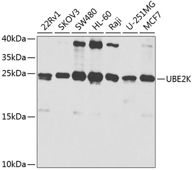 HIP2 Antibody in Western Blot (WB)