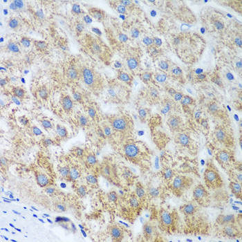 UBE2U Antibody in Immunohistochemistry (Paraffin) (IHC (P))