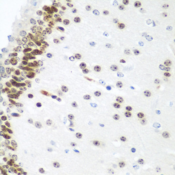 UBE2U Antibody in Immunohistochemistry (Paraffin) (IHC (P))