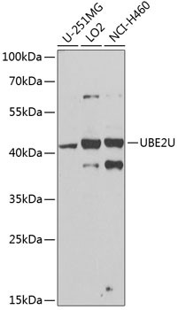 UBE2U Antibody in Western Blot (WB)