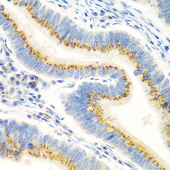 UBIAD1 Antibody in Immunohistochemistry (Paraffin) (IHC (P))