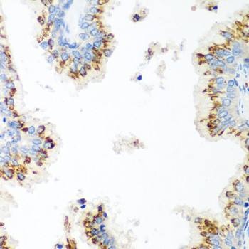 UBIAD1 Antibody in Immunohistochemistry (Paraffin) (IHC (P))