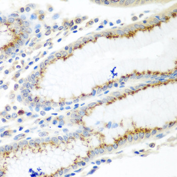 UBIAD1 Antibody in Immunohistochemistry (Paraffin) (IHC (P))