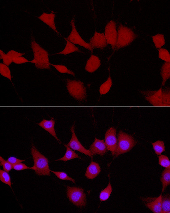 UCHL5 Antibody in Immunocytochemistry (ICC/IF)