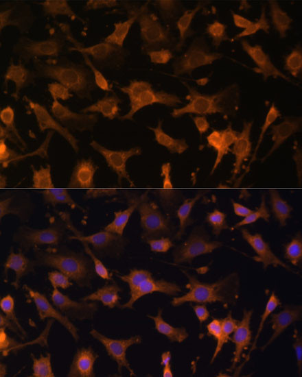 UFC1 Antibody in Immunocytochemistry (ICC/IF)