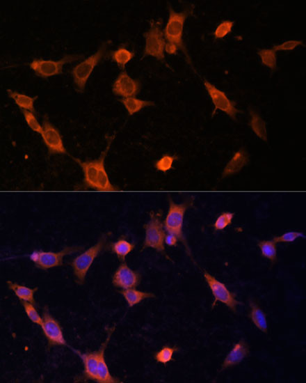 UFC1 Antibody in Immunocytochemistry (ICC/IF)