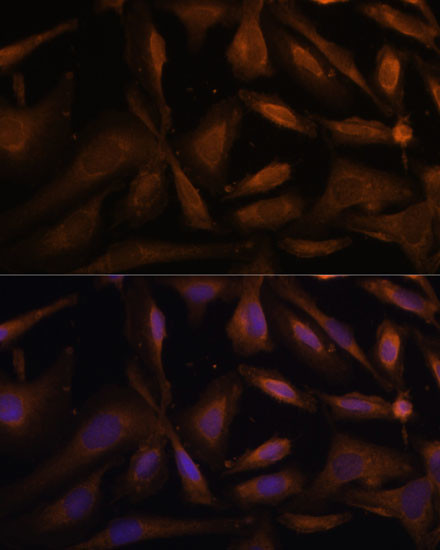 UFC1 Antibody in Immunocytochemistry (ICC/IF)