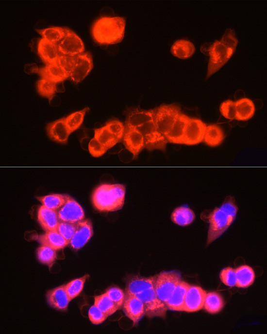 USP18 Antibody in Immunocytochemistry (ICC/IF)