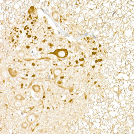 USP18 Antibody in Immunohistochemistry (Paraffin) (IHC (P))