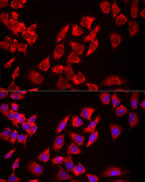 USP21 Antibody in Immunocytochemistry (ICC/IF)