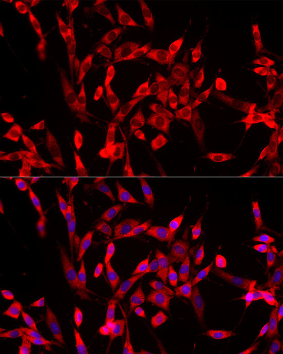 USP21 Antibody in Immunocytochemistry (ICC/IF)