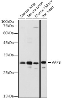 VAPB Antibody in Western Blot (WB)