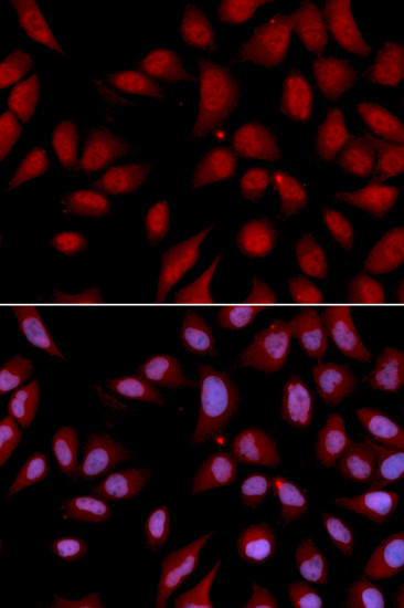 DLG7 Antibody in Immunocytochemistry (ICC/IF)