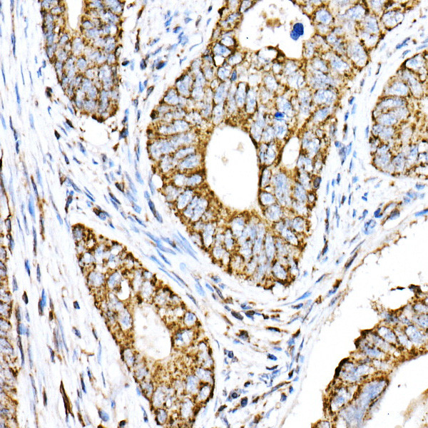 VPS4A Antibody in Immunohistochemistry (Paraffin) (IHC (P))