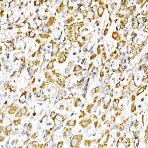 VPS4A Antibody in Immunohistochemistry (Paraffin) (IHC (P))