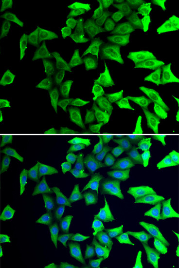 VSNL1 Antibody in Immunocytochemistry (ICC/IF)