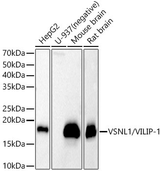 VSNL1 Antibody in Western Blot (WB)